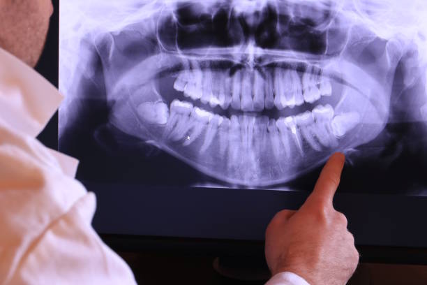 Urgent Tooth Repair in SD